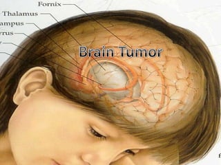 Brain Cancer Prognosis
 