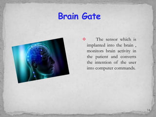  The sensor which is
implanted into the brain ,
monitors brain activity in
the patient and converts
the intention of the user
into computer commands.
14
 