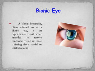  A Visual Prosthesis,
often referred to as a
bionic eye, is an
experimental visual device
intended to restore
functional vision in those
suffering from partial or
total blindness .
17
 