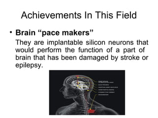 Achievements In This Field
• Brain “pace makers”
They are implantable silicon neurons that
would perform the function of a part of
brain that has been damaged by stroke or
epilepsy.
 