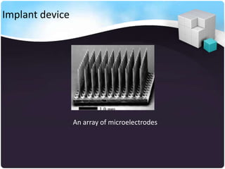 Implant device




                 An array of microelectrodes
 