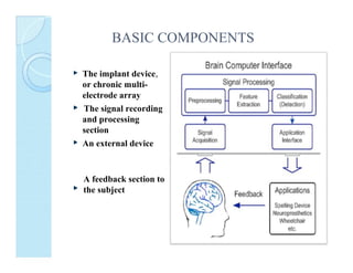 BASIC COMPONENTS
The implant device,
or chronic multielectrode array
The signal recording
and processing
section
An external device

A feedback section to
the subject

 