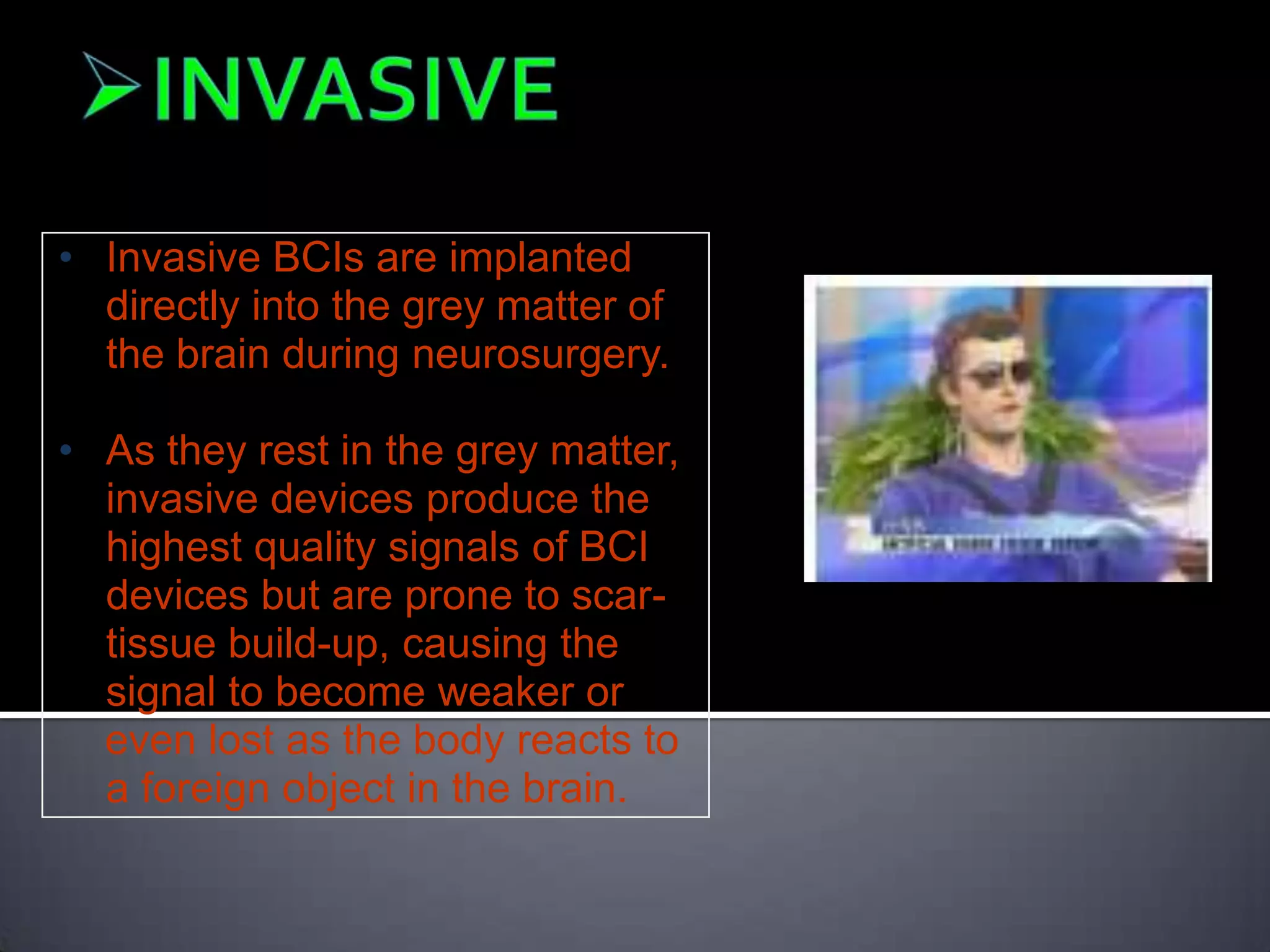 • Invasive BCIs are implanted
directly into the grey matter of
the brain during neurosurgery.
• As they rest in the grey matter,
invasive devices produce the
highest quality signals of BCI
devices but are prone to scartissue build-up, causing the
signal to become weaker or
even lost as the body reacts to
a foreign object in the brain.

 