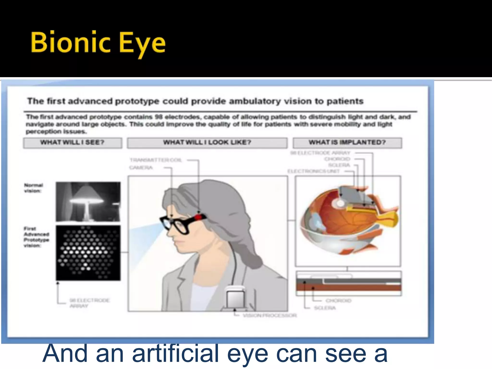 And an artificial eye can see a

 