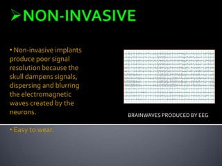 • Non-invasive implants
produce poor signal
resolution because the
skull dampens signals,
dispersing and blurring
the electromagnetic
waves created by the
neurons.

• Easy to wear.

BRAINWAVES PRODUCED BY EEG

 