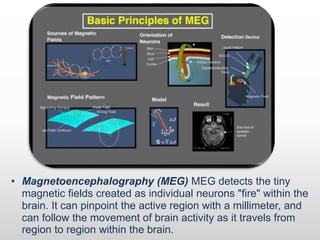 • Magnetoencephalography (MEG) MEG detects the tiny
magnetic fields created as individual neurons "fire" within the
brain. It can pinpoint the active region with a millimeter, and
can follow the movement of brain activity as it travels from
region to region within the brain.
 