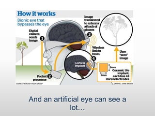 Bionic Eye
And an artificial eye can see a
lot…
 