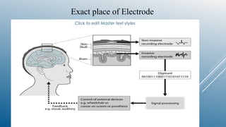 Click to edit Master text styles
Exact place of Electrode
 
