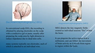 Electroencephalography( EEG)
In conventional scalp EEG, the recording is
obtained by placing electrodes on the scalp
with a conductive gel or paste, usually after
preparing the scalp area by light abrasion to
reduce impedance due to dead skin cells.
many systems typically use electrodes, each of
which is attached to an individual wire.
Magnetoencephalography (MEG)
MEG detects the tiny magnetic fields
created as individual neurons "fire" within
the brain.
It can pinpoint the active region with a
millimeter, and can follow the movement
of brain activity as it travels from region
to region within the brain.
 