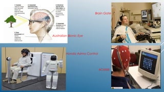 Brain Gate
Australian Bionic Eye
Honda Asimo Control
BCI2000
 
