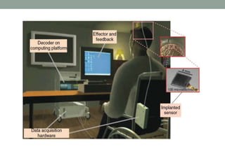 Brain computer interface | PPTX