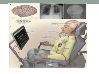 Brain computer interface | PPTX
