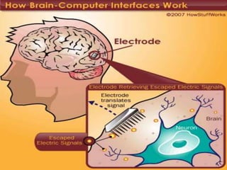 Brain computer interface