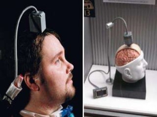Brain computer interface | PPTX