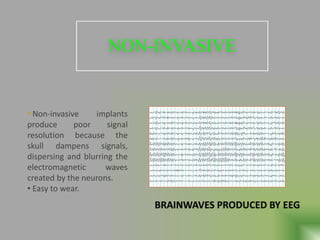NON-INVASIVE
• Non-invasive implants
produce poor signal
resolution because the
skull dampens signals,
dispersing and blurring the
electromagnetic waves
created by the neurons.
• Easy to wear.
BRAINWAVES PRODUCED BY EEG
 