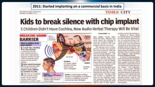 2011: Started implanting on a commercial basis in India
 