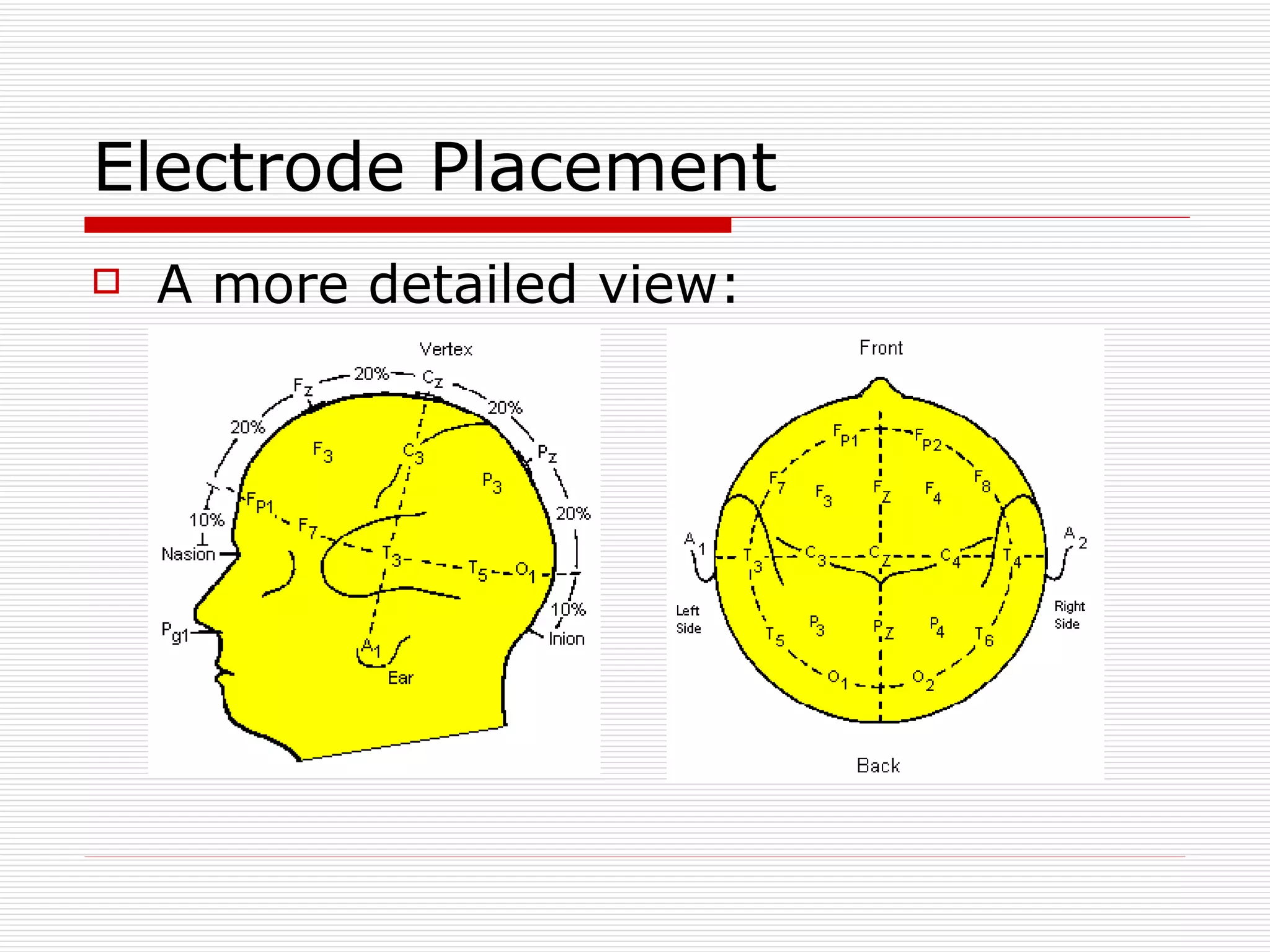 Electrode Placement A more detailed view: 
