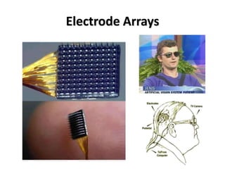 Electrode Arrays
 