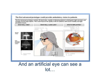 Bionic Eye
And an artificial eye can see a
lot…
 