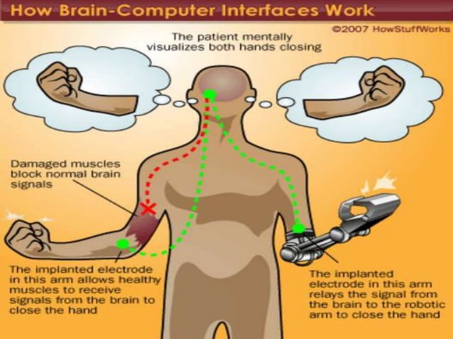 Brain Computer Interfaces(BCI) | PPTX