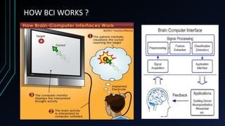 Brain computer interfacing | PPT