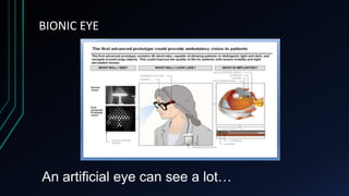 BIONIC EYE
An artificial eye can see a lot…
 