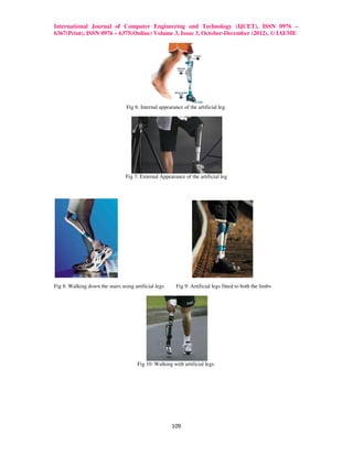 International Journal of Computer Engineering and Technology (IJCET), ISSN 0976 –
6367(Print), ISSN 0976 – 6375(Online) Volume 3, Issue 3, October-December (2012), © IAEME




                                  Fig 6: Internal appearance of the artificial leg.




                                 Fig 7: External Appearance of the artificial leg




Fig 8: Walking down the stairs using artificial legs      Fig 9: Artificial legs fitted to both the limbs




                                       Fig 10: Walking with artificial legs.




                                                        109
 