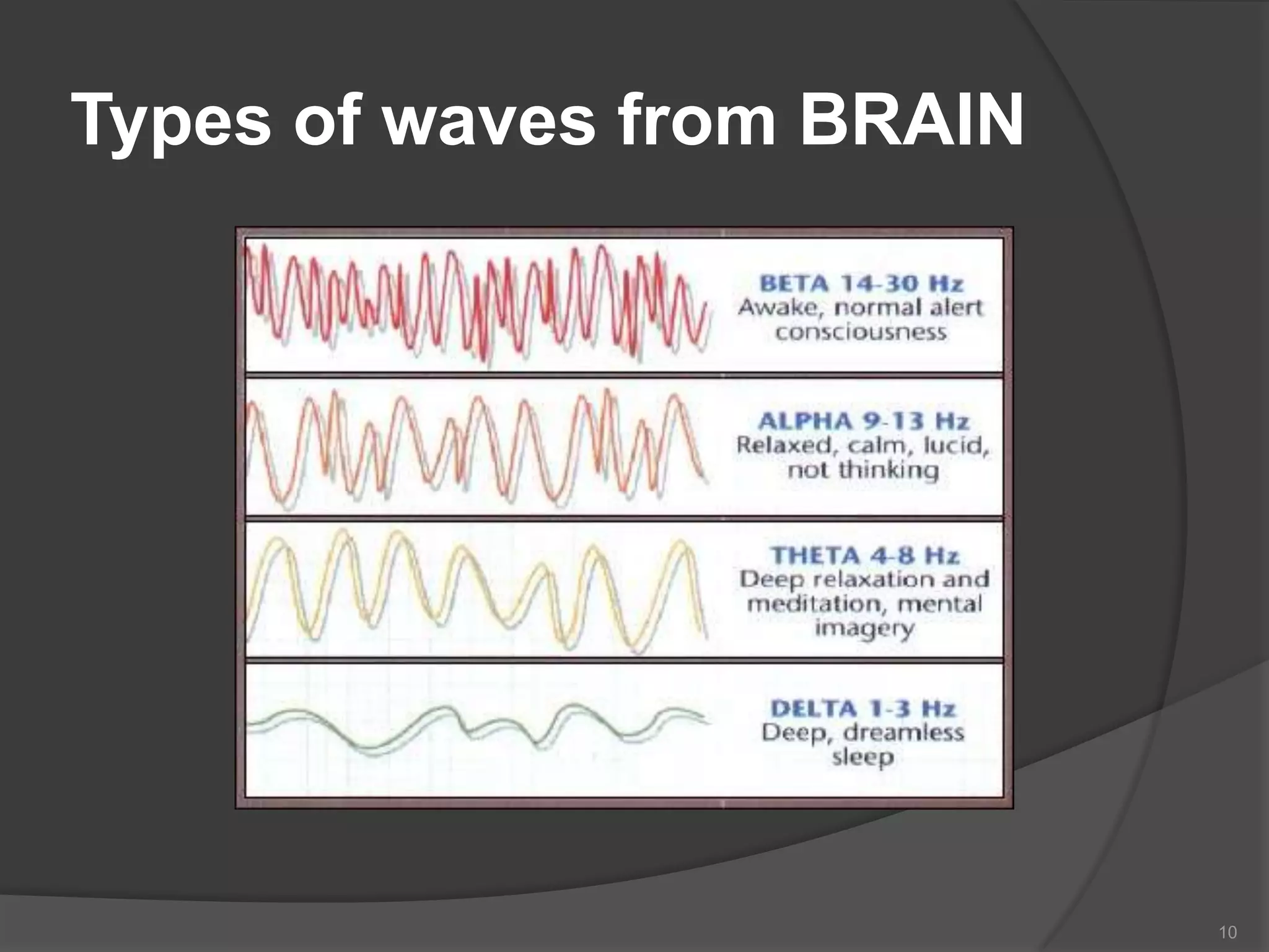 Types of waves from BRAIN

10

 