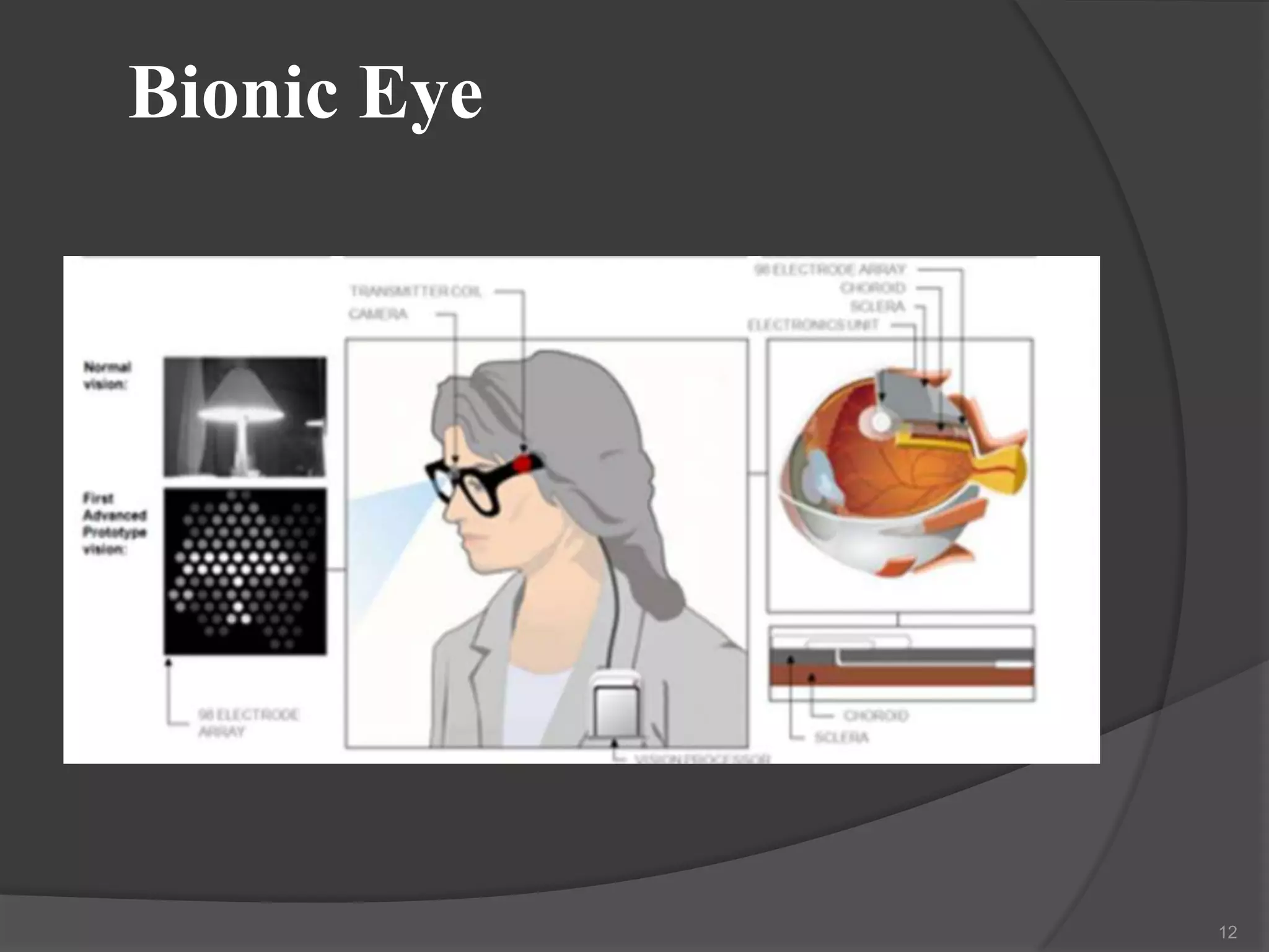 Bionic Eye

12

 