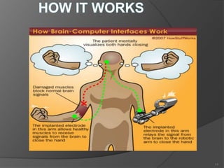 Brain computer interface | PPTX