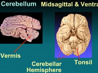 brain and cranial nerve 