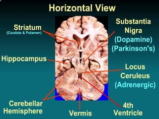 brain and cranial nerve 