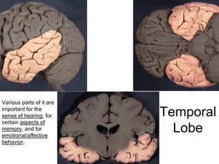 Temporal
Lobe
Various parts of it are
important for the
sense of hearing, for
certain aspects of
memory, and for
emotional/affective
behavior.
 