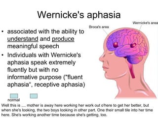 Wernicke's aphasia
• associated with the ability to
understand and produce
meaningful speech
• Individuals with Wernicke's
aphasia speak extremely
fluently but with no
informative purpose ("fluent
aphasia“, receptive aphasia)
Well this is .... mother is away here working her work out o'here to get her better, but
when she's looking, the two boys looking in other part. One their small tile into her time
here. She's working another time because she's getting, too.
normal
 