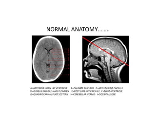 Brain CT Anatomy and Basic Interpretation Part I | PPT