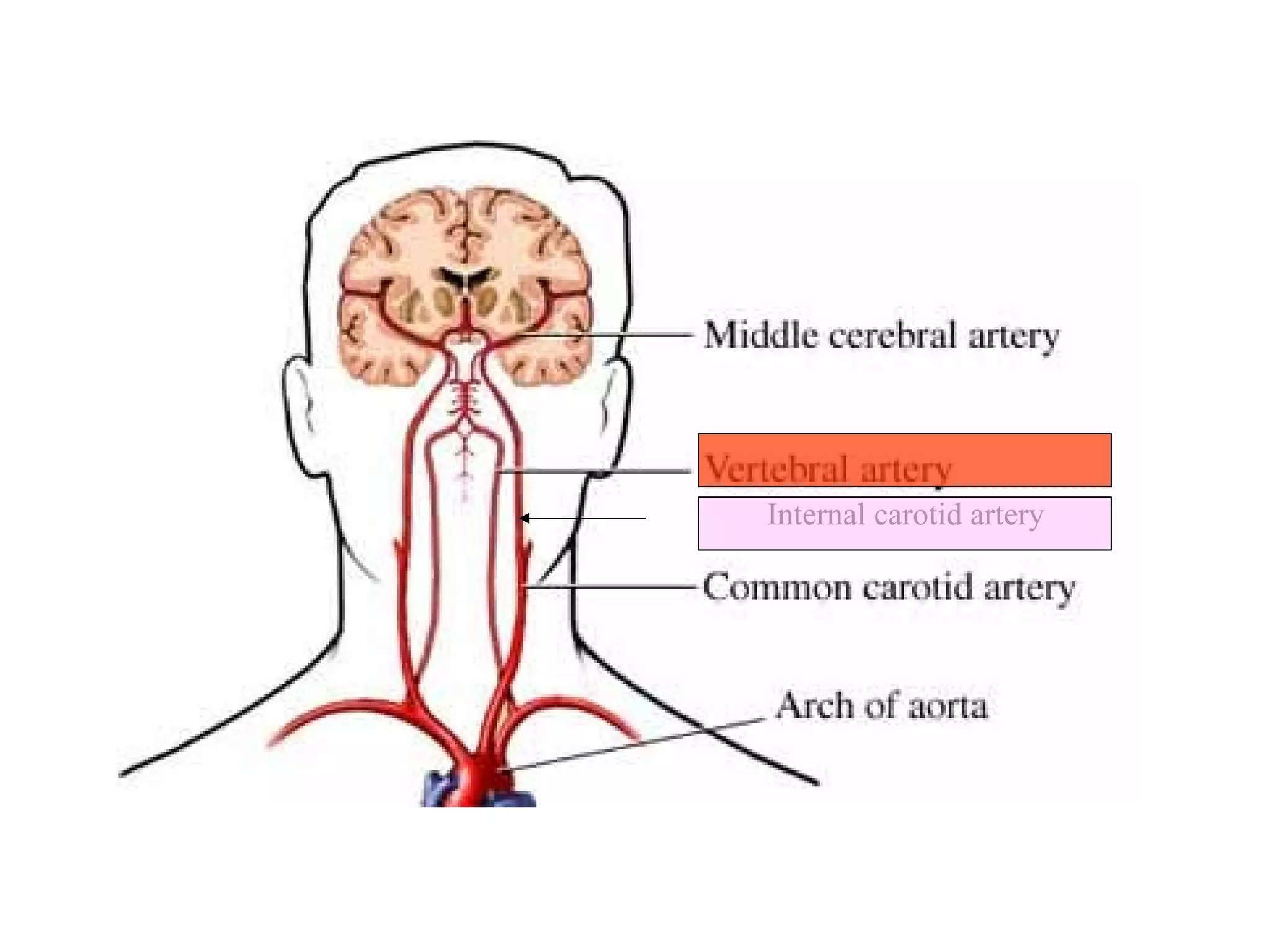 Internal carotid artery
 