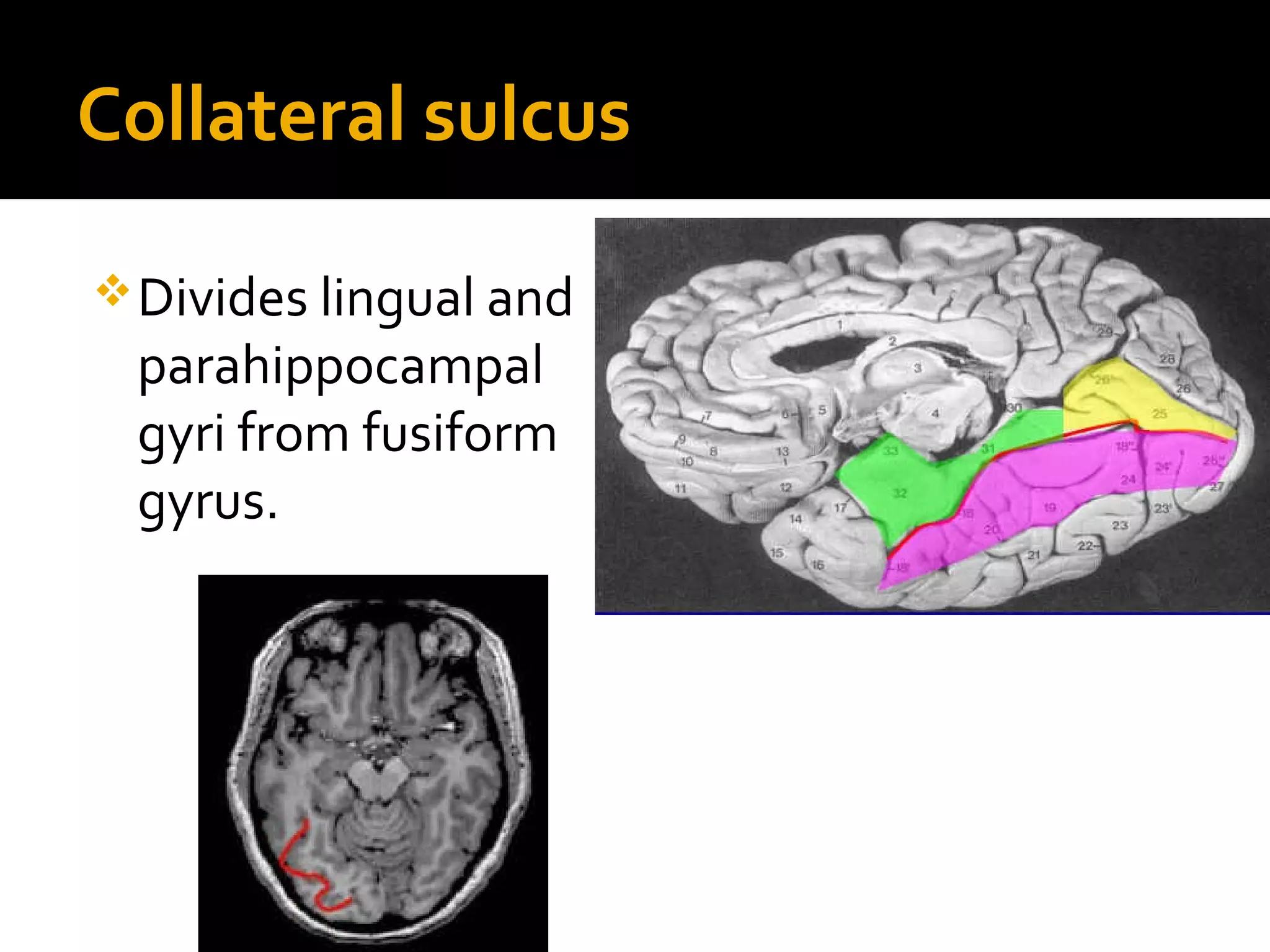 Collateral sulcus
Divides lingual and
parahippocampal
gyri from fusiform
gyrus.
 