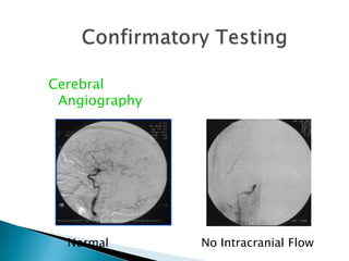 Brain death is a clinical diagnosis. A repeat clinical evaluation 6 hours later is recommended, but this interval is arbitrary. A confirmatory test is not mandatory but is desirable in patients in whom specific components of clinical testing cannot be reliably performed or evaluated. It should be emphasized that any of the suggested confirmatory tests may produce similar results in patients with catastrophic brain damage who do not (yet) fulfill the clinical criteria of brain death.  Confirmatory laboratory tests (Options) 