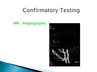 The diagnosis of brain death EELCO FM WIJDICKS N Engl J Med, Vol. 344, No. 16 April 19, 2001