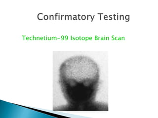 Confirmatory TestingEEGNormalElectrocerebral Silence