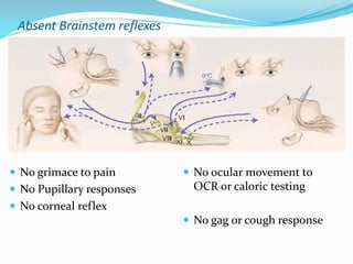 Absent Brainstem reflexes
 No grimace to pain
 No Pupillary responses
 No corneal reflex
 No ocular movement to
OCR or caloric testing
 No gag or cough response
 