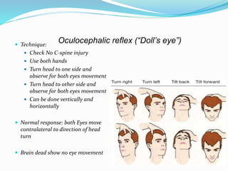 Oculocephalic reflex (“Doll’s eye”) Technique:
 Check No C-spine injury
 Use both hands
 Turn head to one side and
observe for both eyes movement
 Turn head to other side and
observe for both eyes movement
 Can be done vertically and
horizontally
 Normal response: both Eyes move
contralateral to direction of head
turn
 Brain dead show no eye movement
 