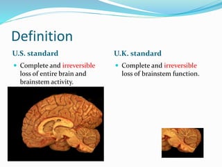 Definition
U.S. standard U.K. standard
 Complete and irreversible
loss of entire brain and
brainstem activity.
 Complete and irreversible
loss of brainstem function.
 