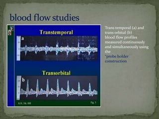 Trans temporal (a) and
trans orbital (b)
blood flow profiles
measured continuously
and simultaneously using
the
“probe holder
construction
 