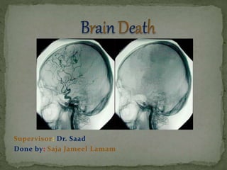 Supervisor: Dr. Saad
Done by: Saja Jameel Lamam
 
