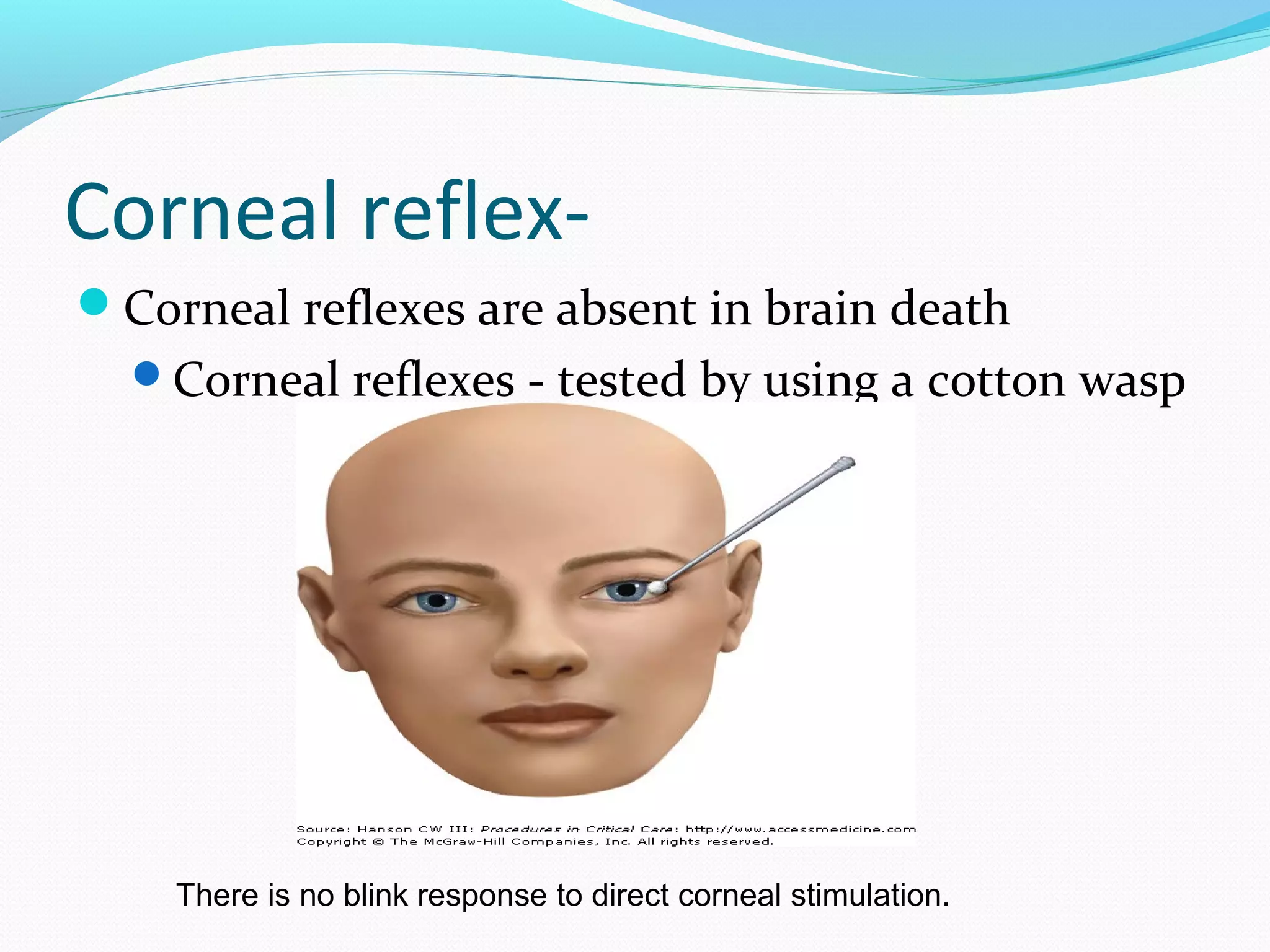 Brain Death Testing Machine Brain death | PPT