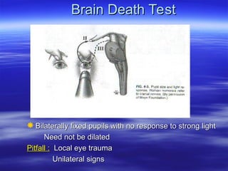 Brain Death Test
Brain Death Test
 Bilaterally fixed pupils with no response to strong light
Bilaterally fixed pupils with no response to strong light
Need not be dilated
Need not be dilated
Pitfall :
Pitfall : Local eye trauma
Local eye trauma
Unilateral signs
Unilateral signs
 
