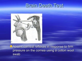 Brain Death Test
Brain Death Test
Absent corneal reflexes in response to firm
Absent corneal reflexes in response to firm
pressure on the cornea using a cotton wool
pressure on the cornea using a cotton wool
swab
swab
 