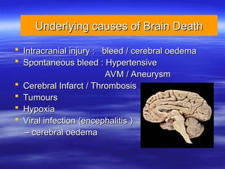 Underlying causes of Brain Death
Underlying causes of Brain Death
 Intracranial injury : bleed / cerebral oedema
Intracranial injury : bleed / cerebral oedema
 Spontaneous bleed : Hypertensive
Spontaneous bleed : Hypertensive
AVM / Aneurysm
AVM / Aneurysm
 Cerebral Infarct / Thrombosis
Cerebral Infarct / Thrombosis
 Tumours
Tumours
 Hypoxia
Hypoxia
 Viral infection (encephalitis )
Viral infection (encephalitis )
–
– cerebral oedema
cerebral oedema
 