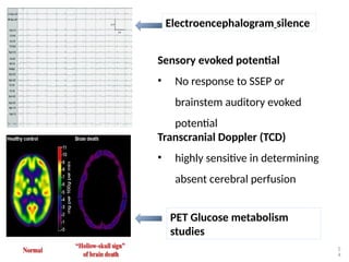 5
4
Electroencephalogram silence
Sensory evoked potential
• No response to SSEP or
brainstem auditory evoked
potential
Transcranial Doppler (TCD)
• highly sensitive in determining
absent cerebral perfusion
PET Glucose metabolism
studies
 